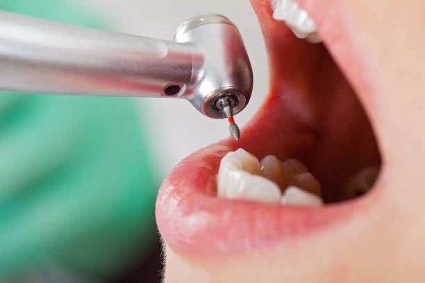Best Emergency Dental Care for Broken or Chipped Teeth in Tabor City, NC